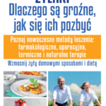 Poradnik na temat leczenia żylaków